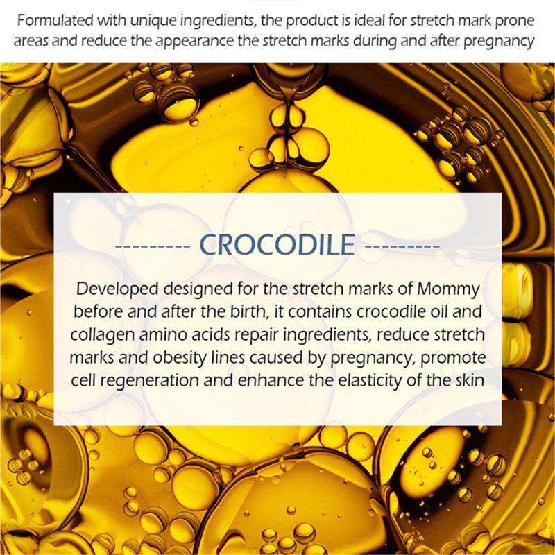 Ready Stock (hàng Mới Về) Kem hỗ trợ giảm Rạn Da Vibrant Glamor Giúp Da Săn Chắc Và Chống Lão Hóa Hiệu Quả COD | BigBuy360 - bigbuy360.vn