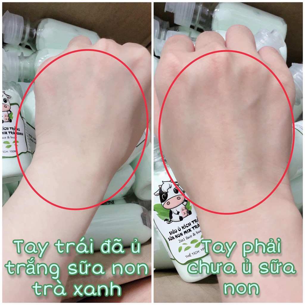 Ủ Sữa Non Kích Trắng Face & Body (mix Trà Xanh) - Hàng Chính Hãng | BigBuy360 - bigbuy360.vn