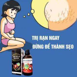 Tinh Dầu Cọ Rạn Da Malaysia Lọ 100ml Cho Mẹ Trước Và Sau Sinh