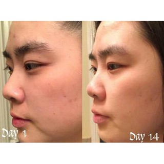 TONER HOA CÚC CALENDULA HERBAL PHYTO SNO