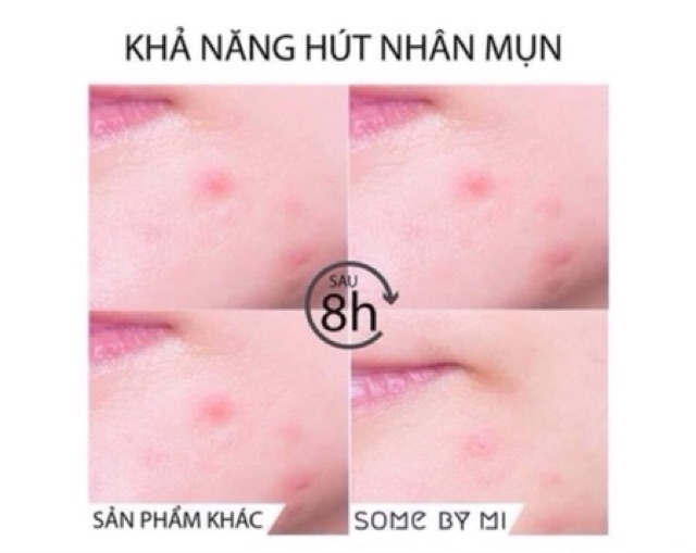 MIẾNG DÁN MỤN SOME BY MI CLEAR SPOT PATCH | BigBuy360 - bigbuy360.vn