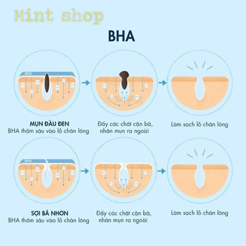 LUCENBASE SaLiCyLic ACid 2%