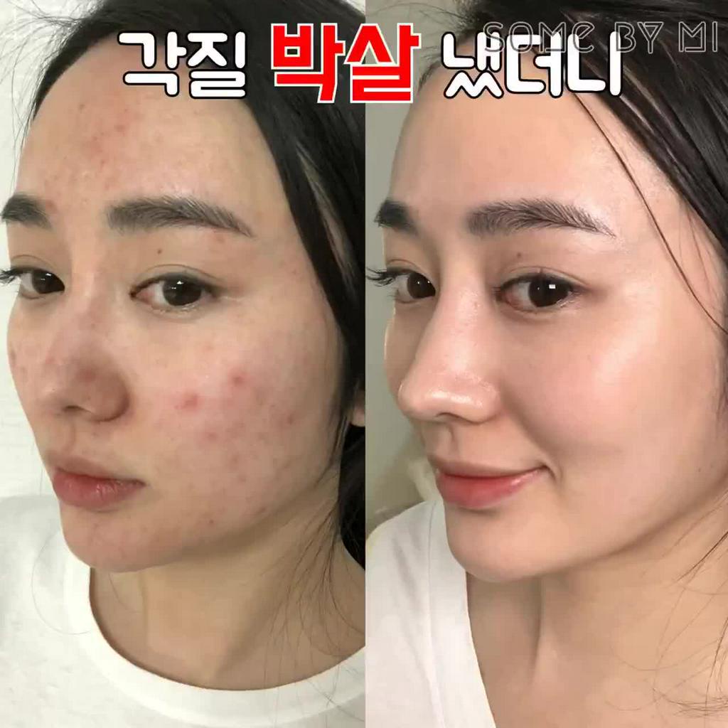 Nước hoa hồng giảm mụn, làm sạch, loại bỏ da chết Hàn Quốc Some By Mi AHA-BHA-PHA 30 Days Miracle Toner 150ml | BigBuy360 - bigbuy360.vn