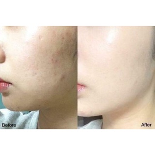 Phấn nước Cushion Ohui