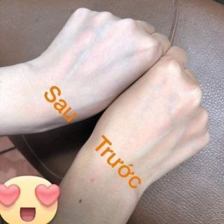 Cấy trắng men sữa