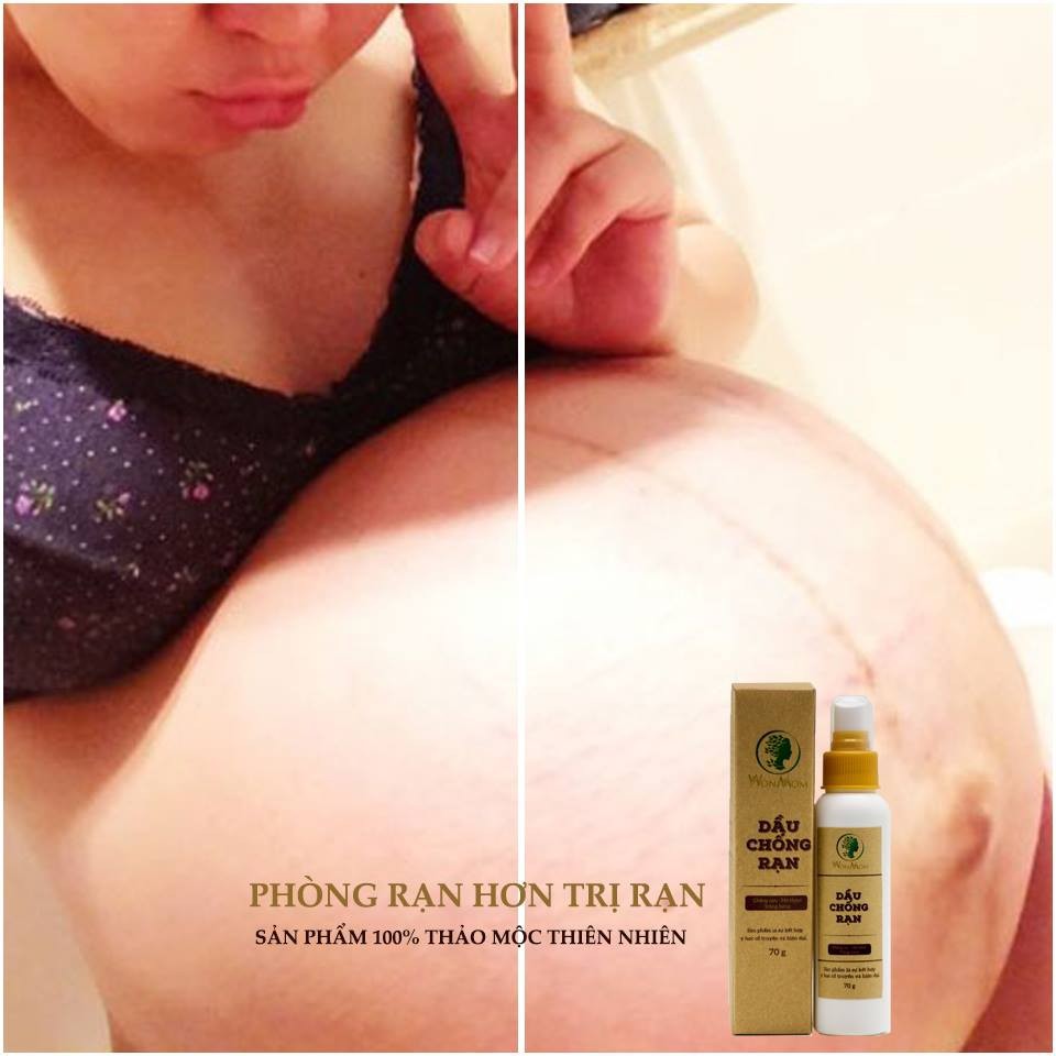 Dầu chống rạn da, dưỡng ẩm, dưỡng sáng da 70gr - WonMom (Việt Nam)