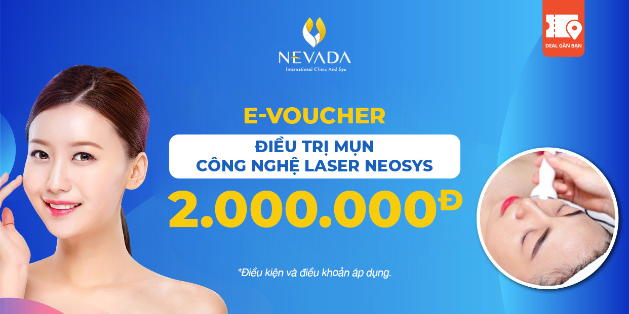 E-Voucher điều trị mụn công nghệ Laser Neosys tại TMV Nevada