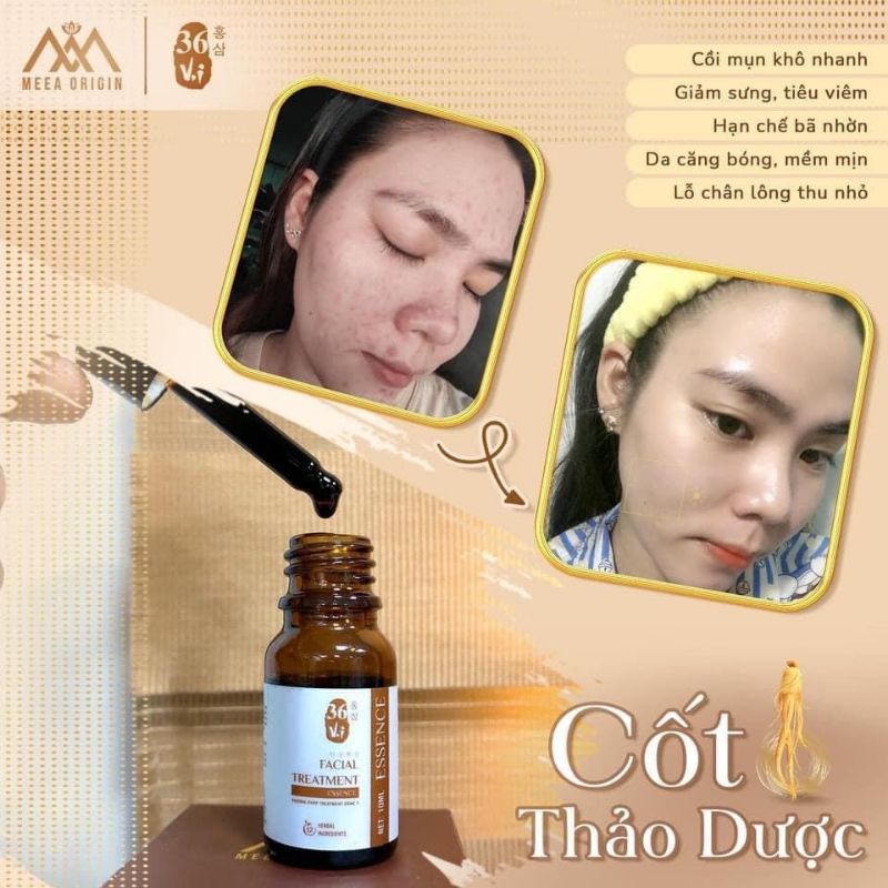 Cốt Thảo Dược 36 Vị 10ML - Chính Hãng - Cốt Huyết Thanh Thảo Dược Cao Mụn Sâm Đỏ Chuyên Gia Về Da