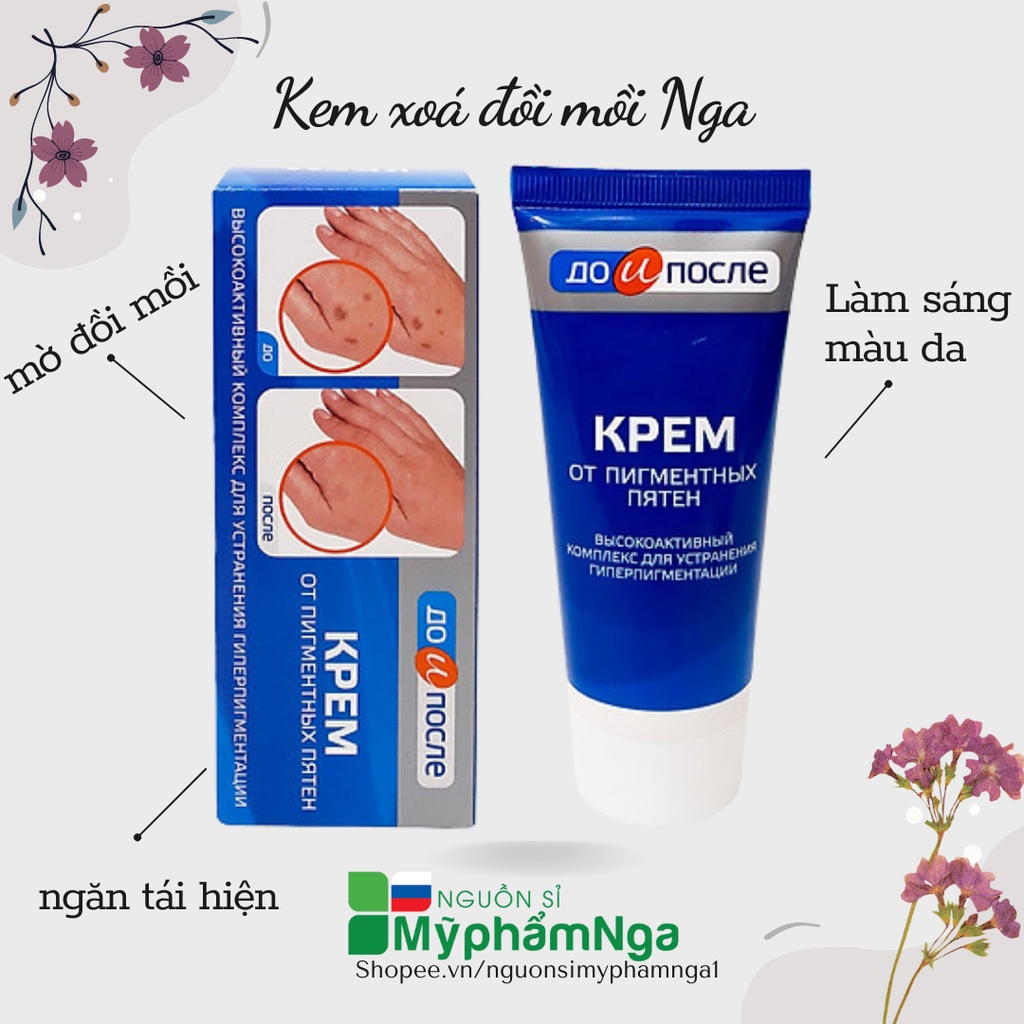 Kem xoá đồi mồi Nga - Kem đồi mồi