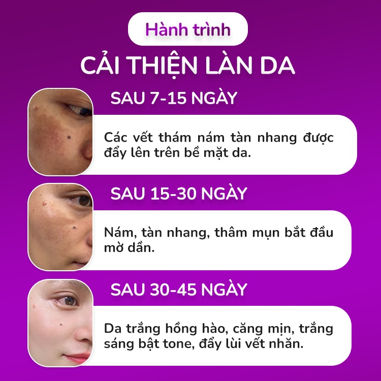 Oriskin Oribeauty 45 Viên ❤️[ CHÍNH HÃNG ] ❤️ Viên Uống Trắng Da Mờ Nám Và Tàn Nhang
