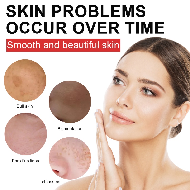 Kem Hỗ trợ giảm tàn nhang Làm Trắng Da Và Loại Bỏ Nám Tàn Nhang Hiệu Quả