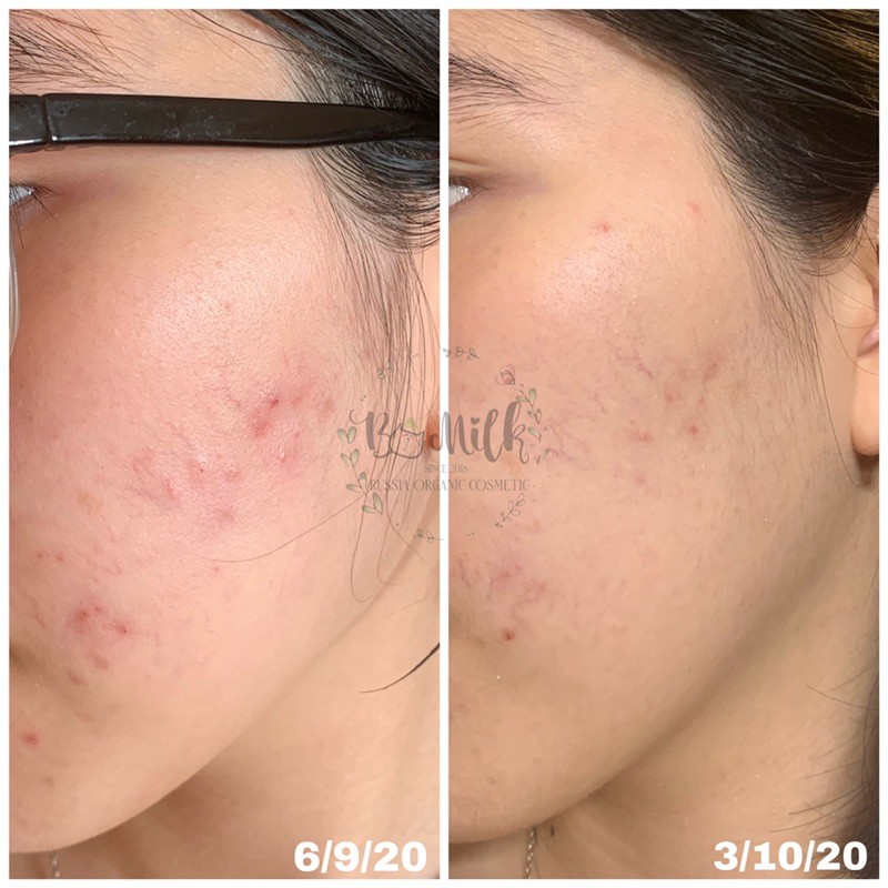 Serum D6 Panthenol - Phục hồi, mờ thâm