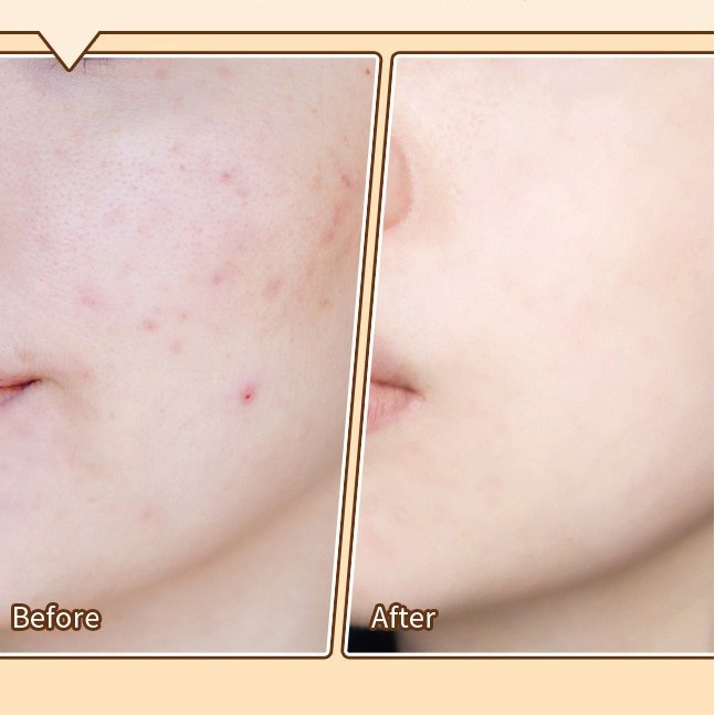 (Hàng Mới Về) Bảng Kem Che Khuyết Điểm 6 Màu Nhẹ Độ Che Phủ Cao Kiss Beauty | BigBuy360 - bigbuy360.vn