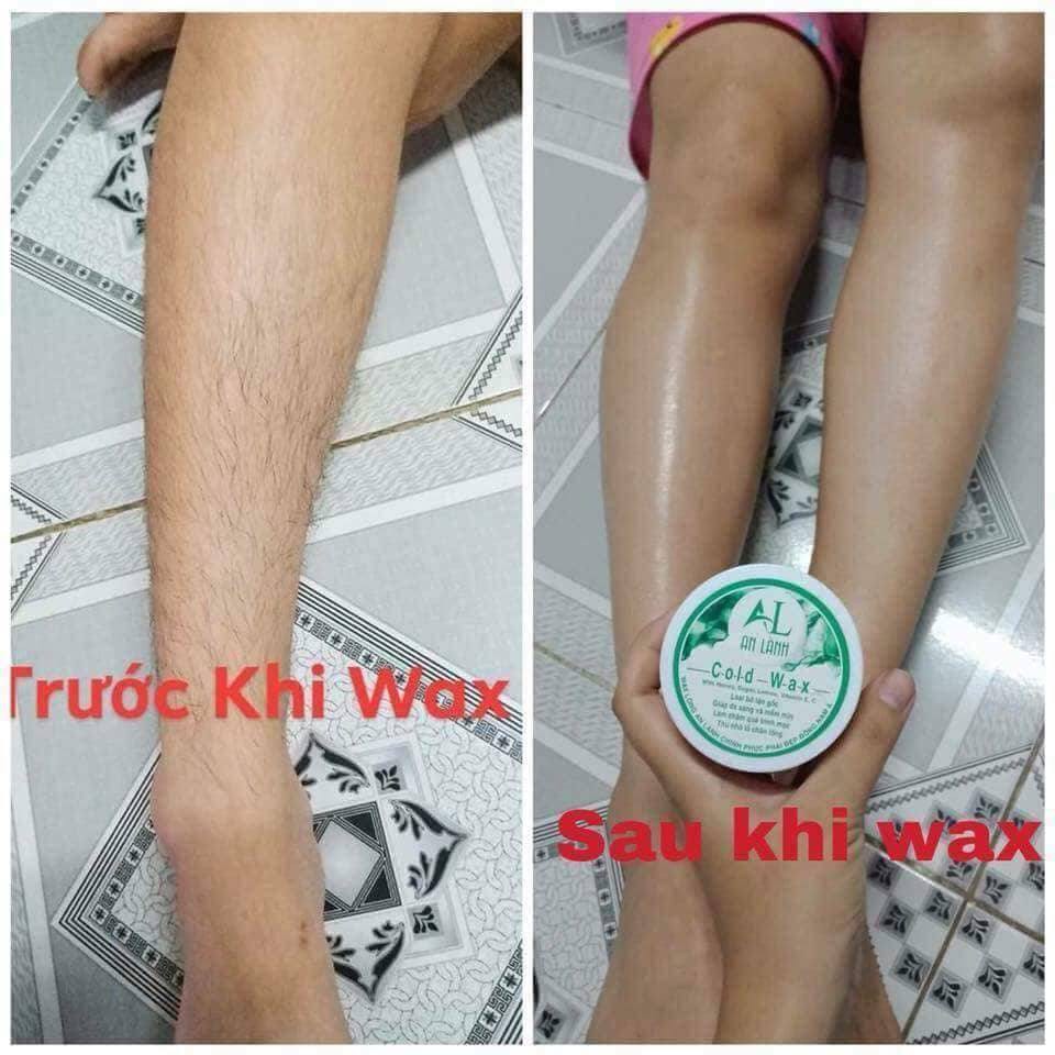 Combo triệt lông An Lành chính hãng (tặng kèm giấy và que wax)