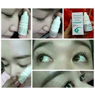 Dung Dịch Làm Dài Mi Careprost Ấn Độ 5ml