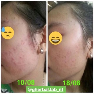 [SALE] bột diếp cá gói lớn