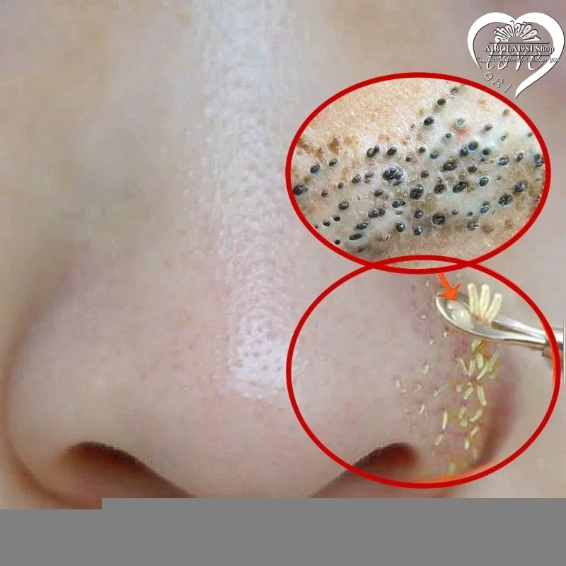 Mặt nạ mũi lột mụn đầu đen làm sạch da | BigBuy360 - bigbuy360.vn