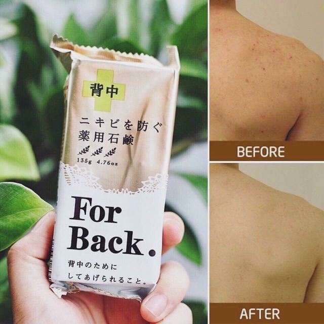Xà phòng mụn lưng For Back Nhật