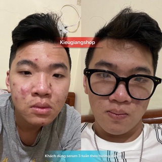 Serum đường đen BLACK SUGAR