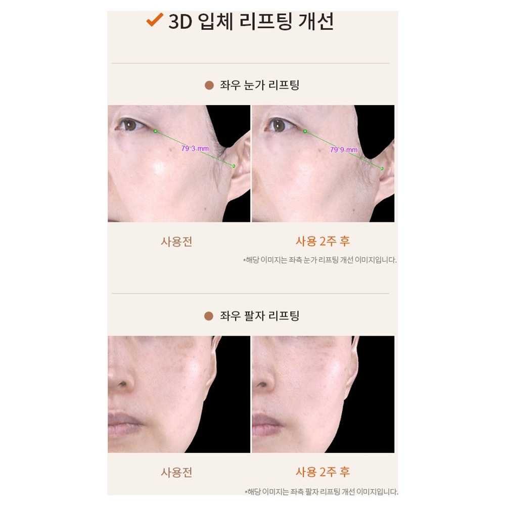 Kem Dưỡng Da Vùng Mắt 100 25ml missha