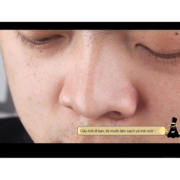[Hàng mới về] Mặt Nạ Bùn Khoáng Lột Mụn Đầu Đen Cho Vùng Mũi