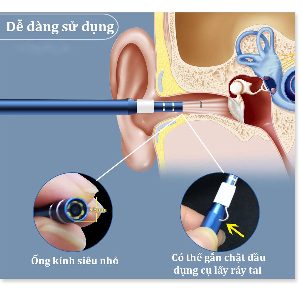 Dụng Cụ Ngoáy Tai Cho Bé ✔️Chính Hãng✔️ 3 trong 1 có đèn LED, Nội Soi Tai Mũi Họng, Có Kết Nối Với Điện Thoại, Máy Tính