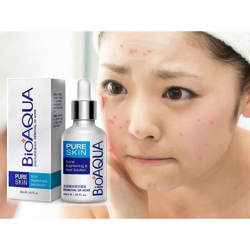 Serum làm sạch mụn Bioaqua Pure Skin 30ml