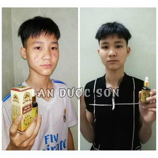 Combo An Dược Sơn Serum Và Bột Thảo Dược 30ml