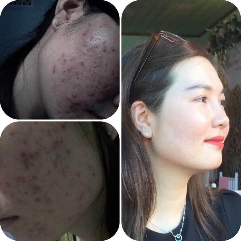 Combo tái tạo da OGANA