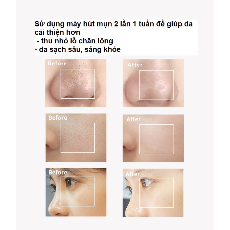 [chính hãng] Máy hút mụn mini cầm tay tiện lợi dạng sạc Dụng cụ làm sạch lỗ chân lông giúp hút mụn cám, đầu đen, bã nhờn
