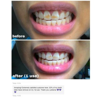 Serum làm trắng răng hãng LANBENA