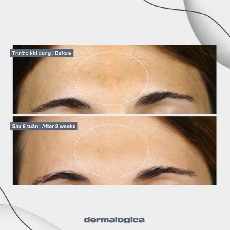 SERUM SÁNG DA, MỜ NÁM POWWER BRIGHT DARK SPOT SERUM DERMALOGICA