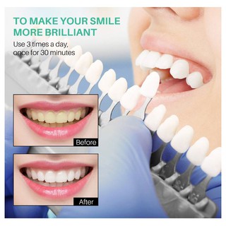 Bộ kit làm trắng răng nha khoa, tẩy trắng răng cấp tốc tại nhà