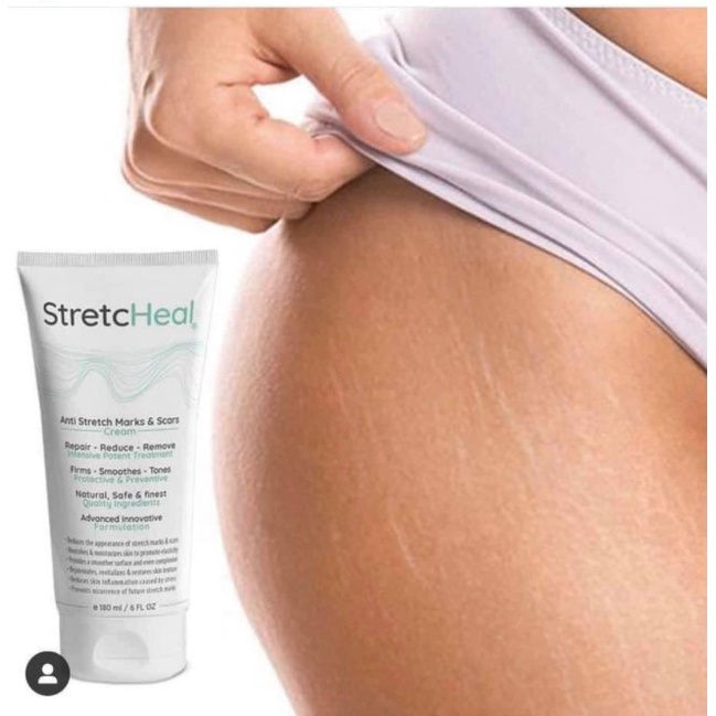 Kem Rạn Da StretcHeal Giữ Ẩm Ngăn Ngừa Rạn Da Giảm Rạn Da Sau Sinh Anti Stretch Marks &amp; Scars Cream 180ml - Khongcoson