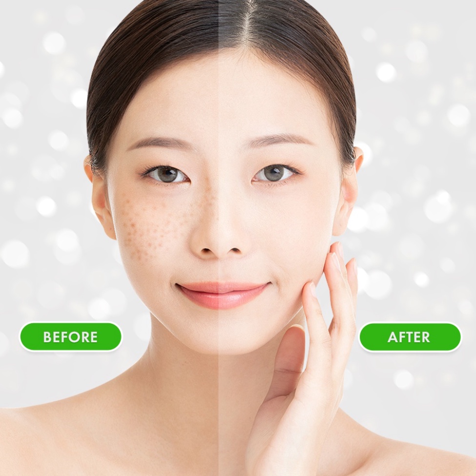 [Chính Hãng] Viên Uống Trắng Da, Chống Nám, Ngăn Ngừa Lão Hóa Oribe - Chiết xuất Hạt Nho Pháp, Collagen nhập khẩu Italia