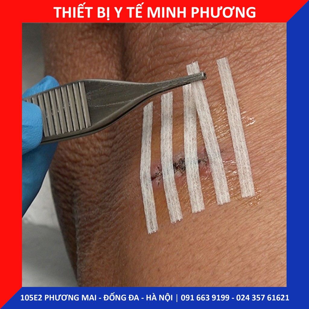 Băng keo dán lành vết thương 3M Steri-Strip