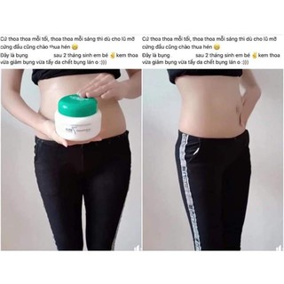 Kem tan mỡ Somatoline mẫu mới