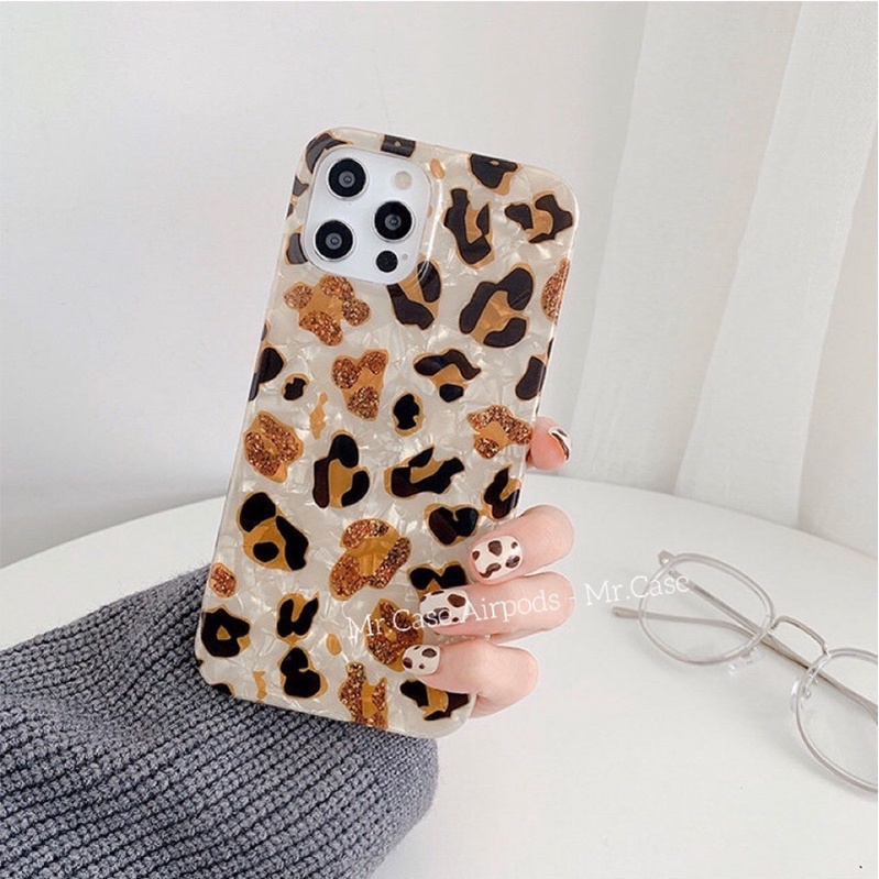 Case iPhone Da Beo Dẻo Dành Cho 12Promax/12/11Promax/Xsmax/X/Xs/7Plus/8Plus  - Mr.CAse
