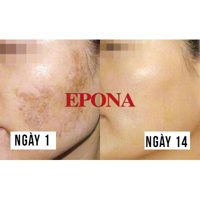 Kem Dưỡng Dầu Ngựa Epona All In One Total Skin Care Intensive