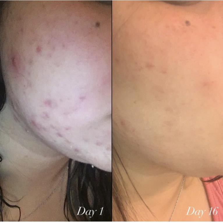 Sample Serum Shani Darden Retinol Reform® Gói 1ml