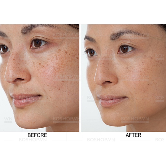 Viên Uống Trắng Da Transino White C Clear 120 Tablets - Mờ Nám Tàn Nhang Từ Nhật Bản