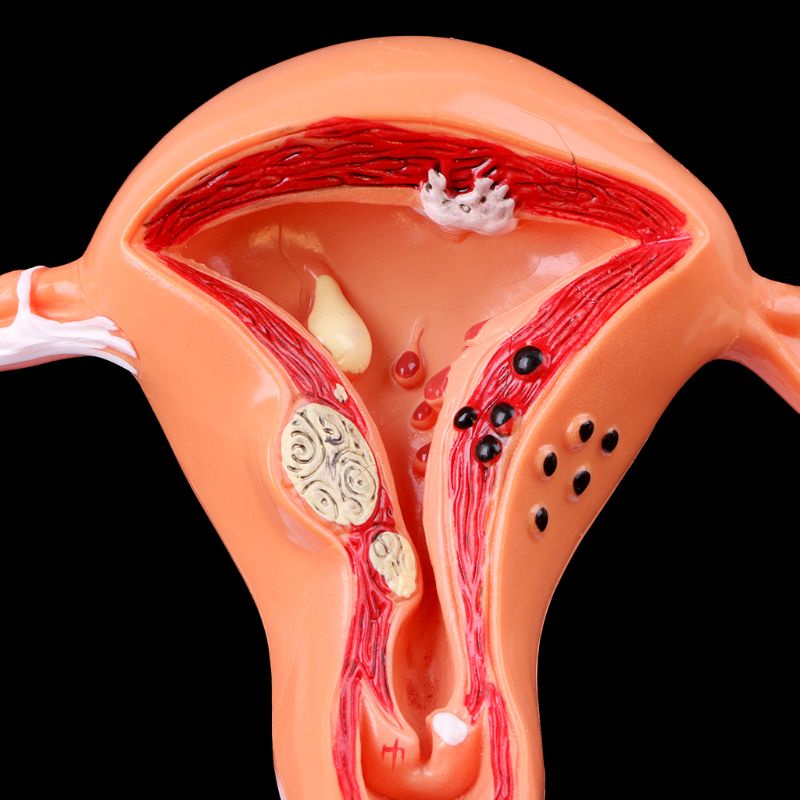 Wer Mô Hình Giải Phẫu Uterus Ovary Cho Học Sinh