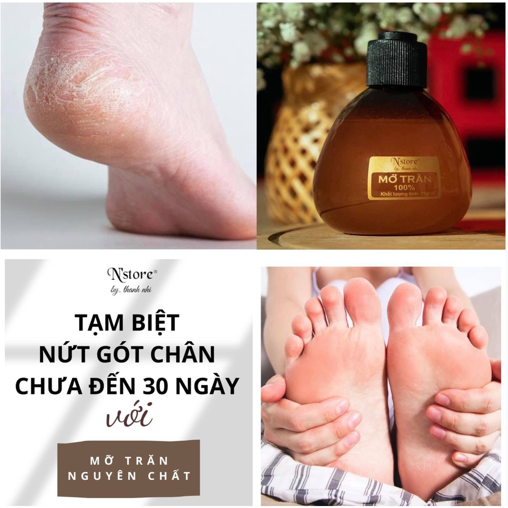 Mỡ trăn triệt lông nguyên chất chính hãng N'store date mới, mỡ trăn gia nhiệt 75g