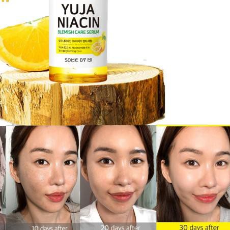 (Hàng Mới Về) Tinh Chất Trị Mụn Somebymi / Some By Mi Yuja Niacin 50ml