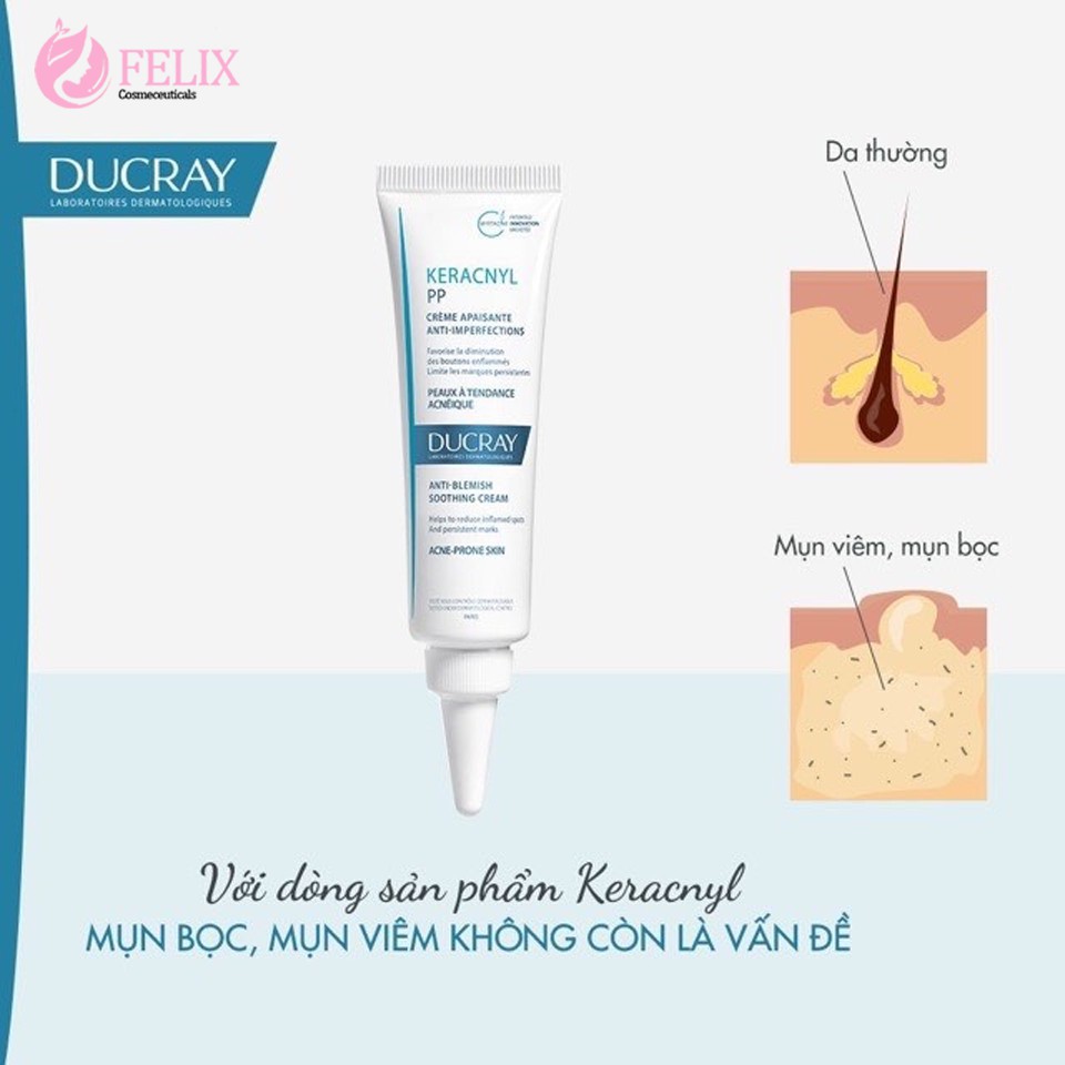 [NHẬP KHẨU] Kem hỗ trợ giảm mụn trứng cá DUCRAY Keracnyl PP Anti-Blemish Soothing Cream Ducray 30ml