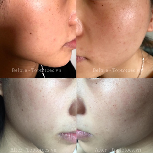 [HÀNG NHẬP KHẨU] Serum Teana Super Peptides ASAP dưỡng trắng, mờ thâm, cải thiện kết cấu da | BigBuy360 - bigbuy360.vn