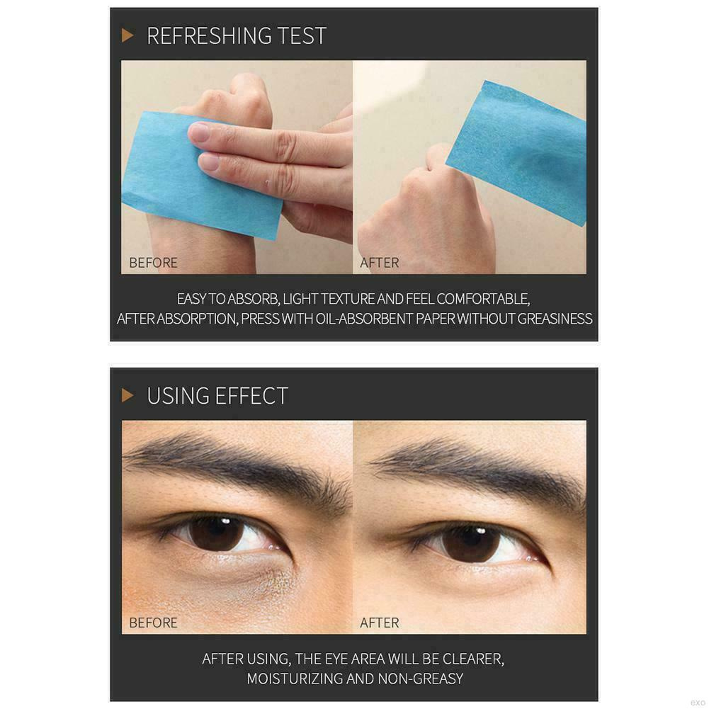 Kem Dưỡng Da Mắt 20g Chống Lão Hóa Xóa Mờ Quầng Thâm / Bọng Mắt Dưỡng Ẩm Giảm Nếp Nhăn Cho Nam