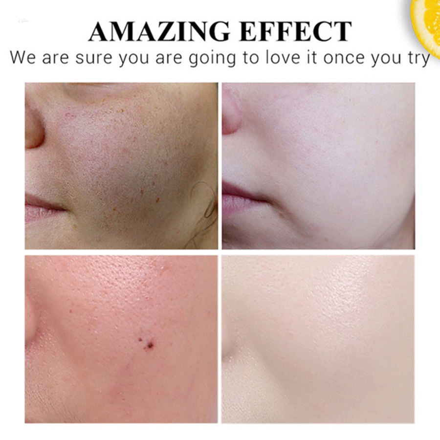 Kem Vitamin C 20% Làm Trắng Xóa Đốm Đen Trên Da Mặt Hiệu GLAMN