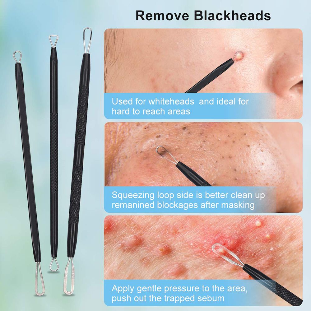 [Hàng mới về] Set dụng cụ nặn mụn hai đầu bằng thép không gỉ kèm hộp đựng màu đen chăm sóc da cho nữ