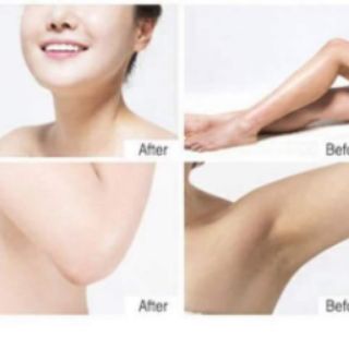 Kem dưỡng trắng da body